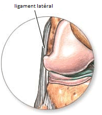 ligament lateral entorse genou