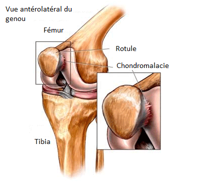 Vue antérolatérale du genou